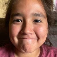 Scott Frost-alperstein profile photo